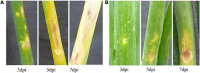 Comparative Transcriptome Analysis of Onion in Response to Infection by Alternaria porri (Ellis) Cifferi